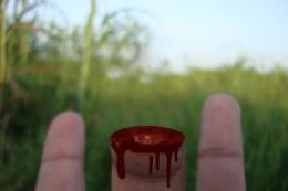 finger cut